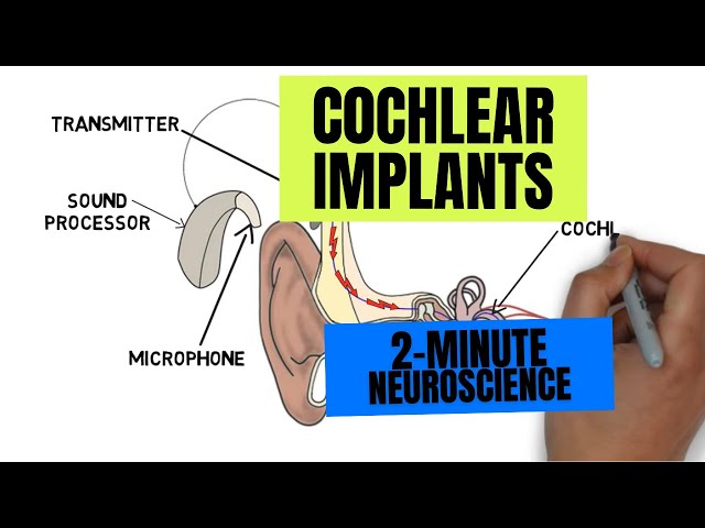 2-Minute Neuroscience: Cochlear Implants