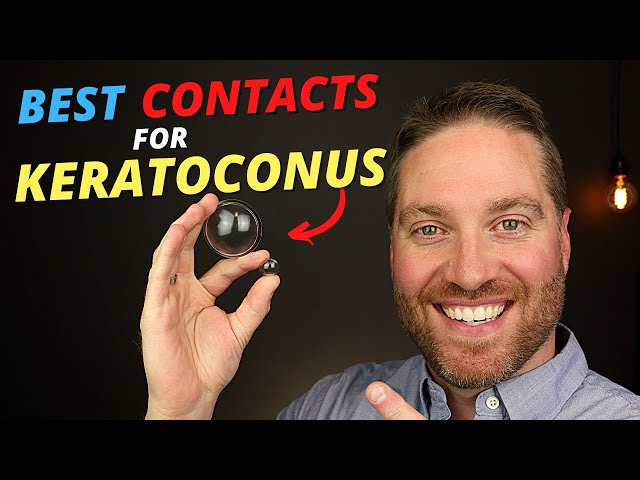 Top 5 BEST Contact Lenses For Keratoconus!