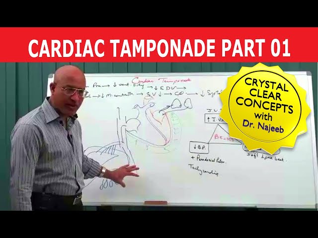 Cardiac Tamponade | Cardiology | Part 1/5