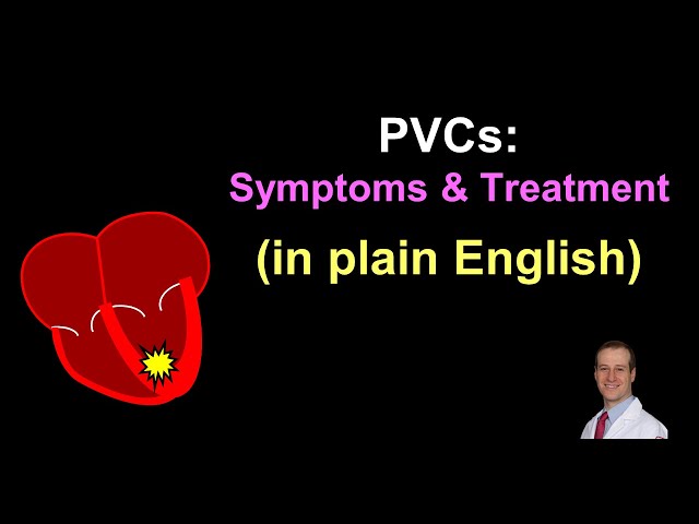 PVCs: Symptoms and Treatment - in Plain English!