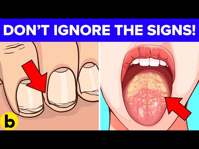 8 Common Cancer Signs That Are Almost Always Ignored