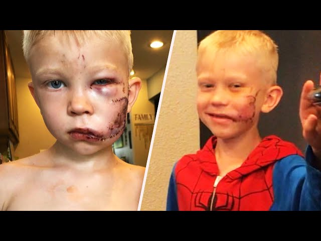Boy Who Saved Sister in Dog Attack Gets Call from Spider-Man