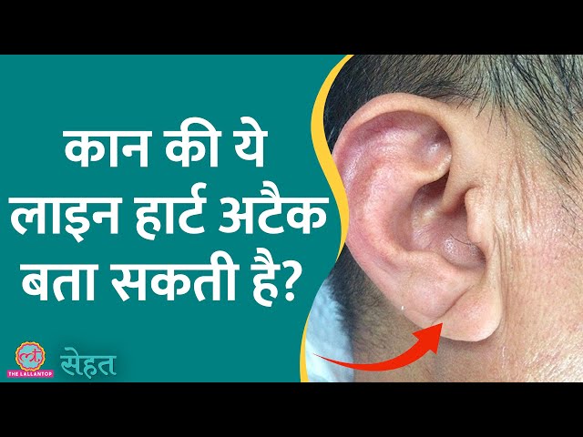 क्या है Ear lobe crease theory जो कानों को देखकर बताती है Heart Attack पड़ने वाला है? | Sehat 804