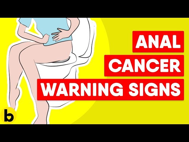 Causes, Warning Signs, And Prevention Of Anal Cancer