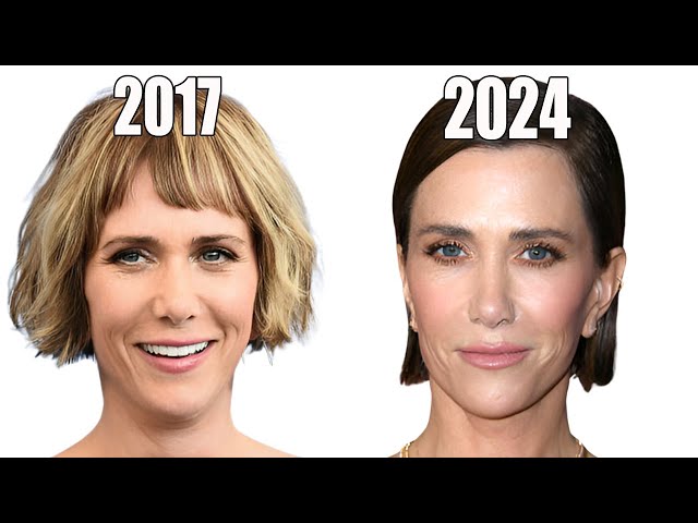 Kristen Wiig's NEW Face: This is CRAZY!!!