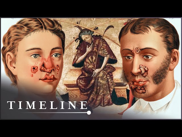 1495 Syphilis Outbreak: The Deadly Disease That Swept Across Europe | The Syphilis Enigma | Timeline