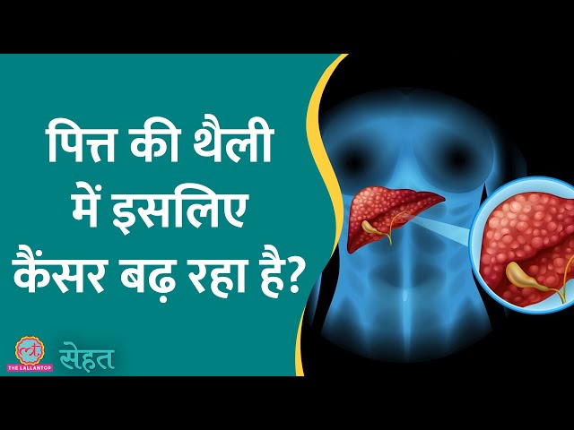 India में तेज़ी से बढ़ रहे हैं Gallbladder Cancer के मामले, जानिए इससे कैसे बचें? | Sehat ep 843