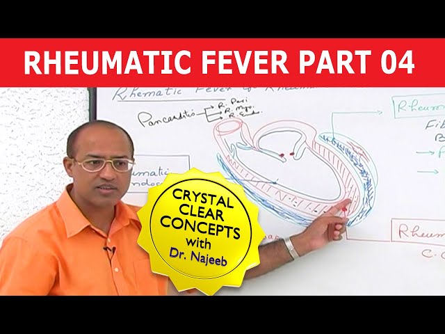 Rheumatic Fever & Heart Disease Part 4/7