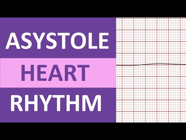 Asystole Heart Rhythm ECG Causes, Treatment Nursing NCLEX Review EKG Flatline