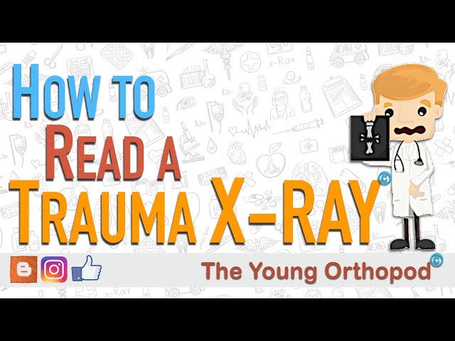 How to Read an X RAY (Trauma Radiograph) - The Young Orthopod