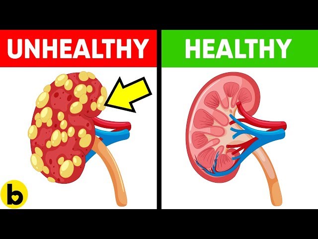 Eat THESE 13 SUPER Foods That Make Your Kidneys HEALTHY!