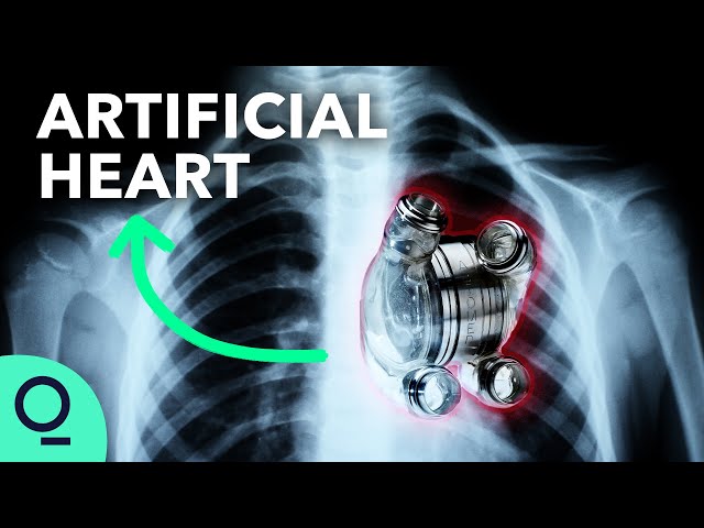 Permanent Artificial Hearts Are Closer Than You Think