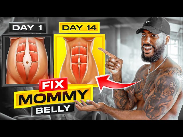 FIX MOMMY BELLY - 2 WEEKS (DO THIS EVERYDAY!)