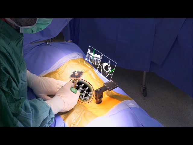 How an AR Surgery Headset Works | The Henry Ford’s Innovation Nation