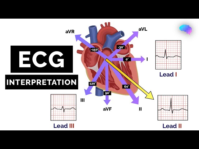 How to Read an ECG | ECG Interpretation | EKG | OSCE Guide | UKMLA | CPSA