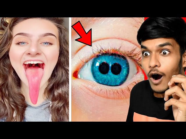 Rare BODY Parts That Only 0.001% People Have | In Hindi