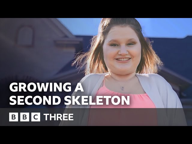 I'm Growing A Second Skeleton | Living Differently