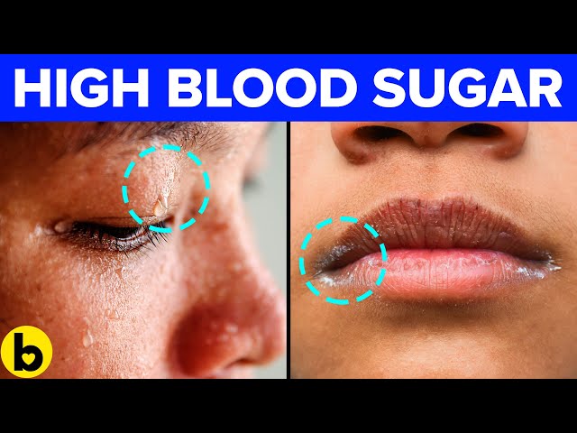 Your Blood Sugar IS HIGH! - 9 Warning Signs To Look Out For