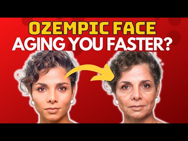 PREVENT OZEMPIC FACE FAT LOSS with these 3 simple FACE YOGA EXERCISES