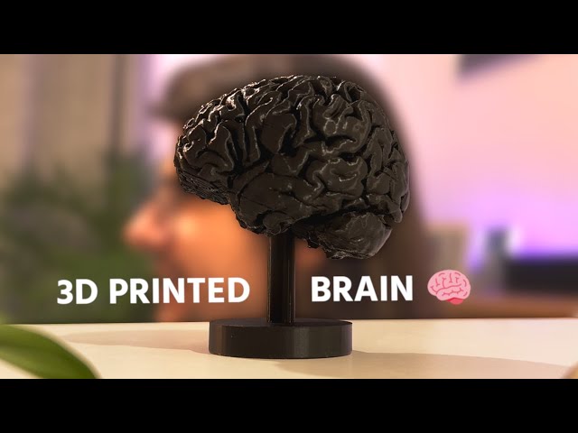 From MRI to 3D Print: My brain in plastic