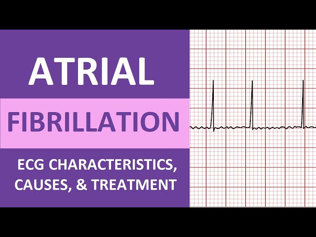 Atrial Fibrillation (A-Fib) ECG, Treatment, Causes, Nursing NCLEX Review ACLS