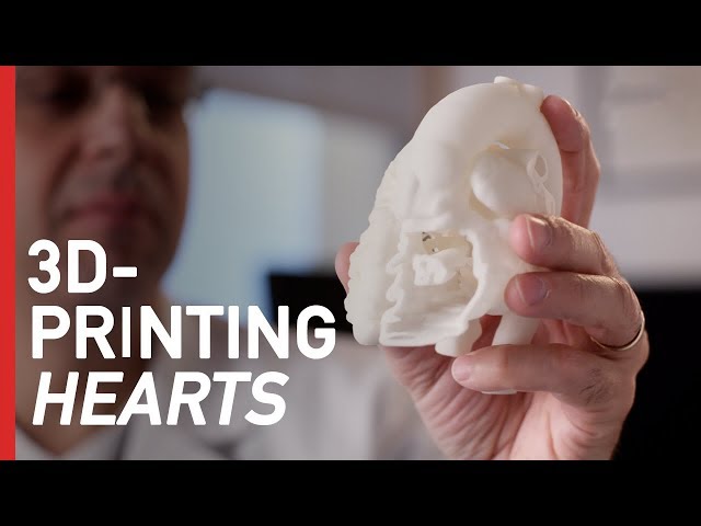 How 3D-Printing is Revolutionizing Heart Surgery