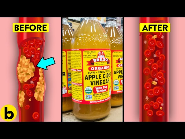 6 SECRET Health Benefits Of Apple Cider Vinegar You're Missing Out On!