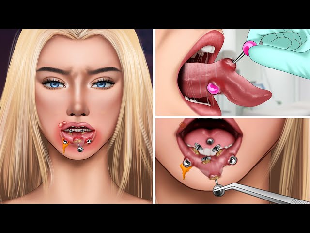 ASMR Treating Inflammation tongue piercings popping pus animation | Body modification