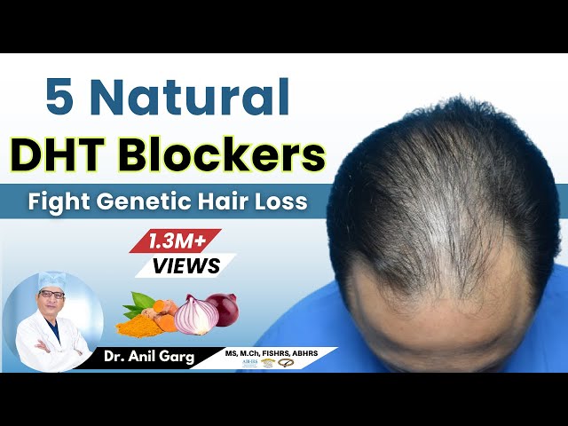 Foods That Block DHT and Fight Hair Loss |  How Can I Reduce DHT Naturally? Dr. Anil Garg