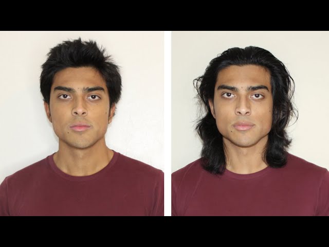My 1 Year Face Transformation