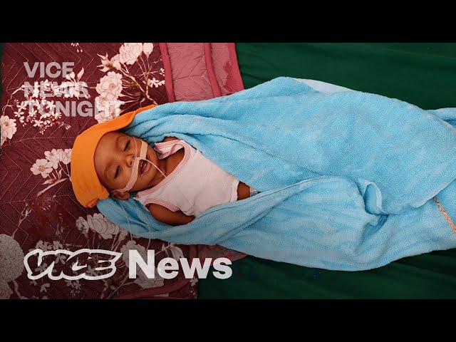 Children in Yemen Are So Hungry They’re Eating Their Own Hands