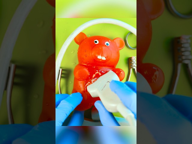 Gummy Surgery Fail😩💔🪦Satisfying C-section flatline #DiscountDentist #FruitSurgery #FoodSurgery