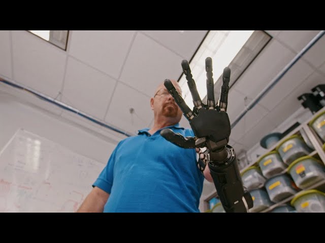 The Real Bionic Man | Freethink Superhuman