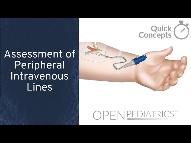 Assessment of Peripheral Intravenous Lines by B. Leary | OPENPediatrics