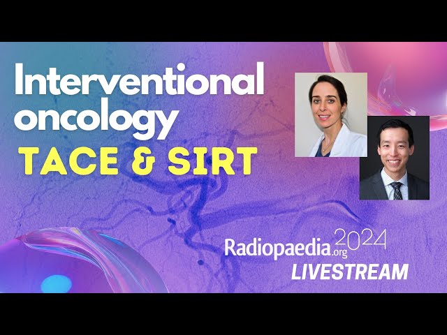 Interventional oncology: TACE & SIRT with Heather Moriarty