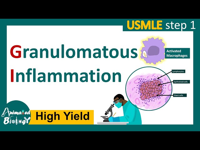 Granulomatous inflammation | What causes granulomatous inflammation ? Pathology for USMLE step 1