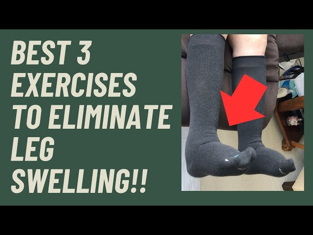 Edema? Swollen Feet? The Best three exercsises to eliminate swelling!