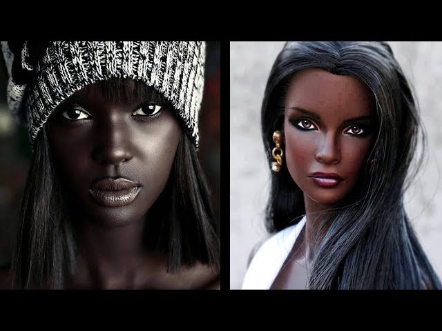7 فتيات يمتلكن أغرب لون بشرة فى العالم .. رقم 2 خلل وراثي غير شكلها تماماً
