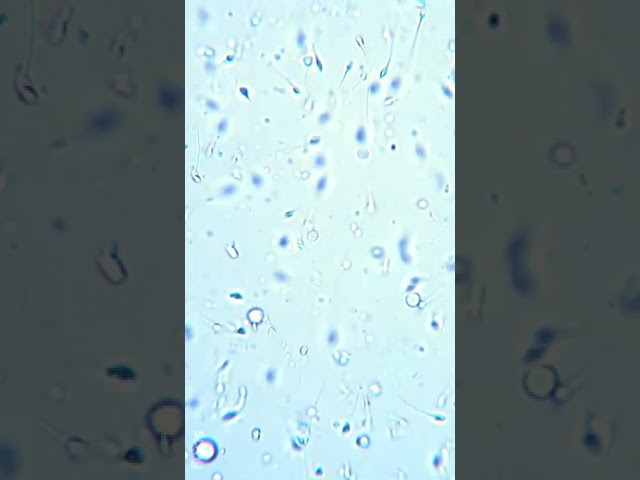 Wie sieht das menschliche Sperma unter dem Mikroskop #shorts