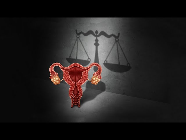 UC Davis LIVE: Abortion and the Supreme Court