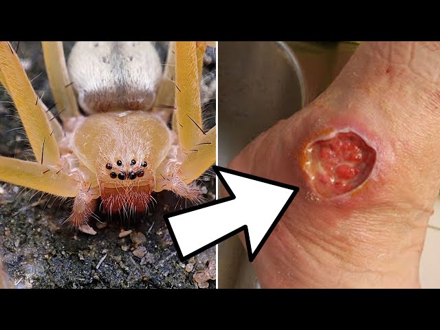 10 Dangerous Animals You Should NEVER Touch!