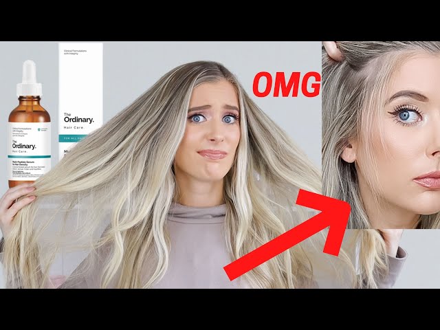 The Ordinary Multi-Peptide Serum for Hair Density Review | The Ordinary Hair Serum Before & After