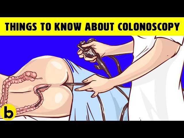 7 Things You Should Know About A Colonoscopy & Colon Health