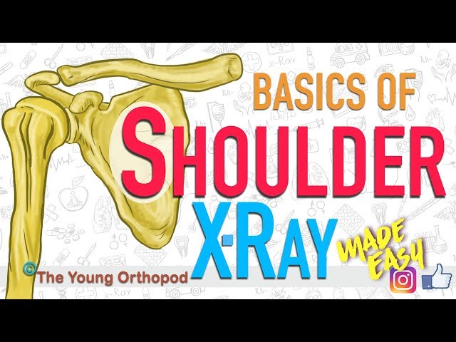 Shoulder X Ray Basics | Shoulder Anatomy | Shoulder Pain | NEET PG | USMLE | The Young Orthopod