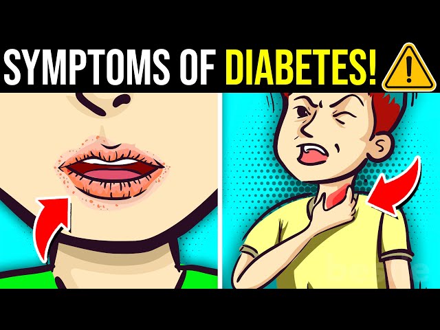 12 UNUSUAL Symptoms Of DIABETES No One Is Telling You About!