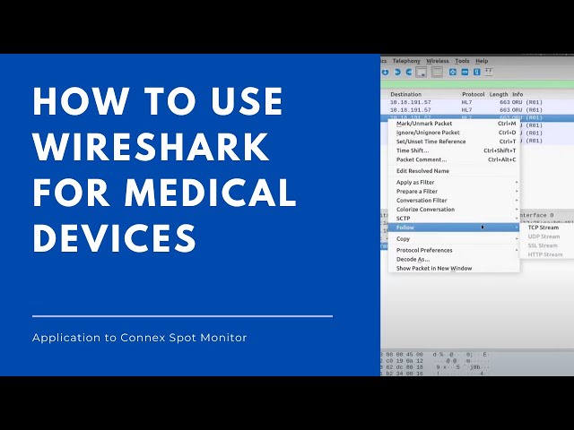 How to use Wireshark for Medical Devices - View Welch Allyn Raw Packet Data
