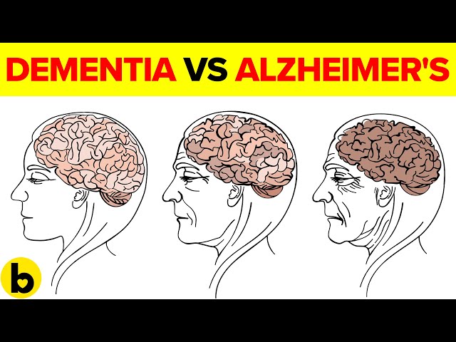 Dementia Vs Alzheimer's: How to Tell the Difference