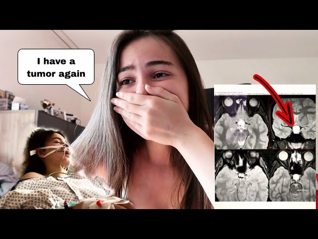 I was diagnosed with a TUMOR PRANK on boyfriend *EMOTIONAL*
