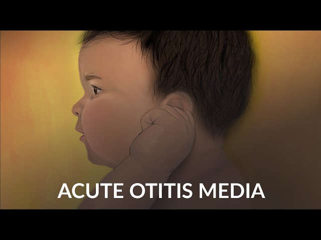 "Acute Otitis Media" by Alex Ruan and Jennifer Cheng