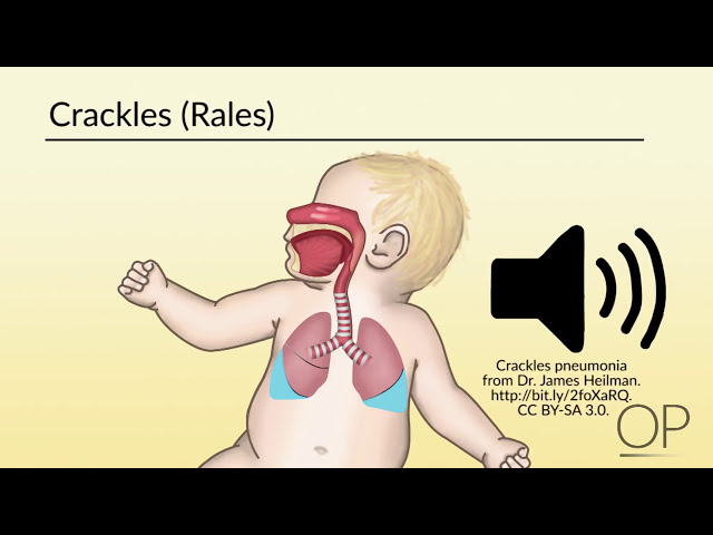 Respiratory Assessment by B. Leary | OPENPediatrics